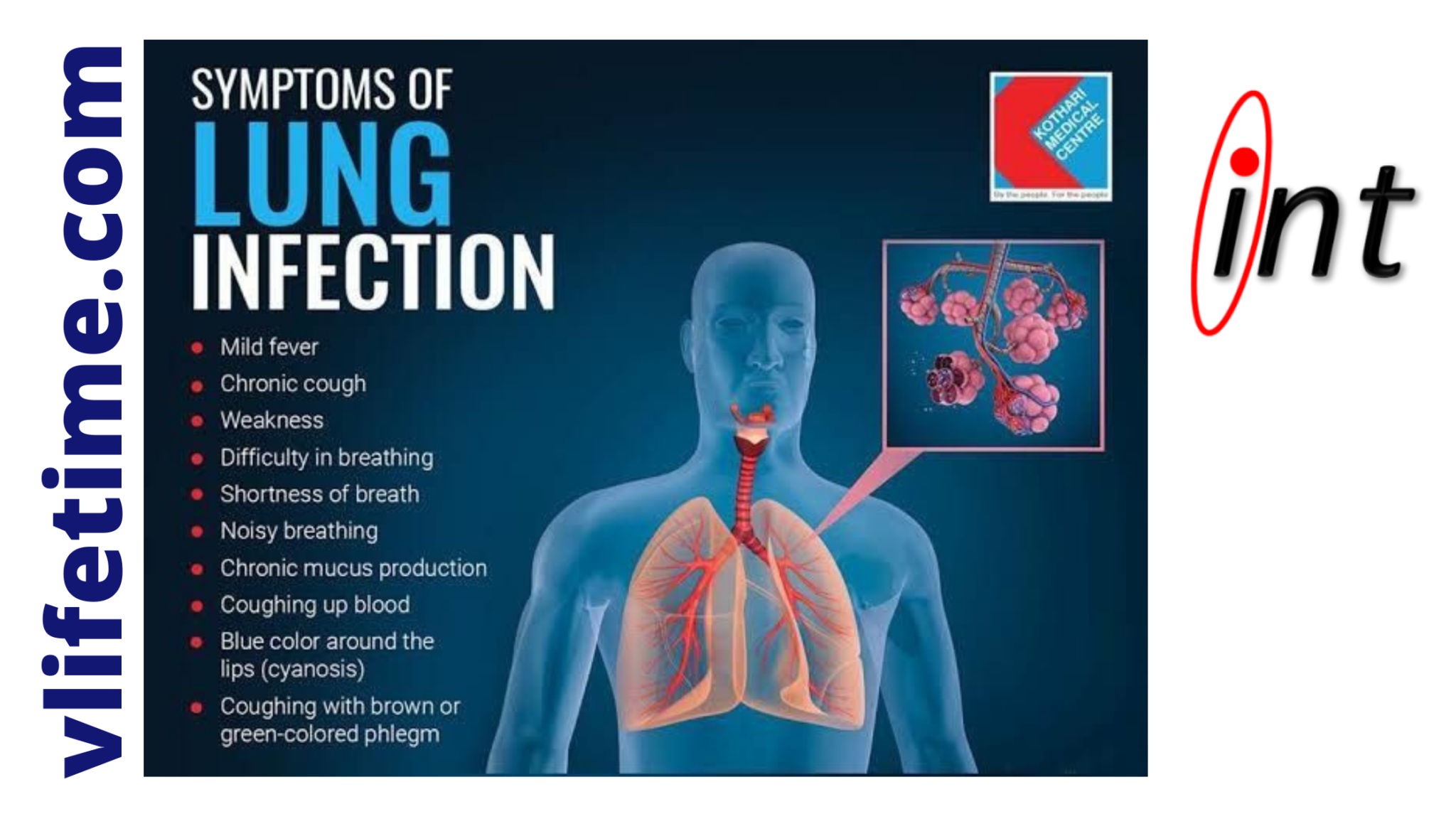 Respiratory Illnesses 13 Types of Lung Infections