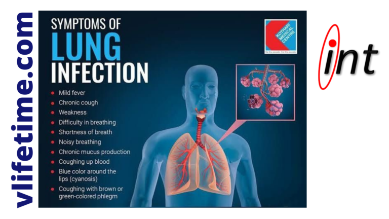 Respiratory Illnesses: 13 Types of Lung Infections