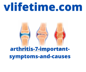 arthritis-7-important-symptoms-and-causes